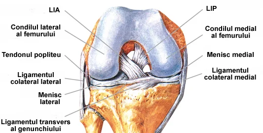 Ruptura de ligament incrucisat posterior