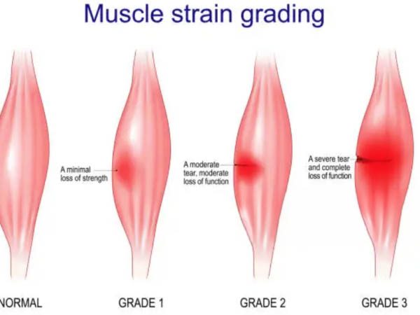 dureri musculare